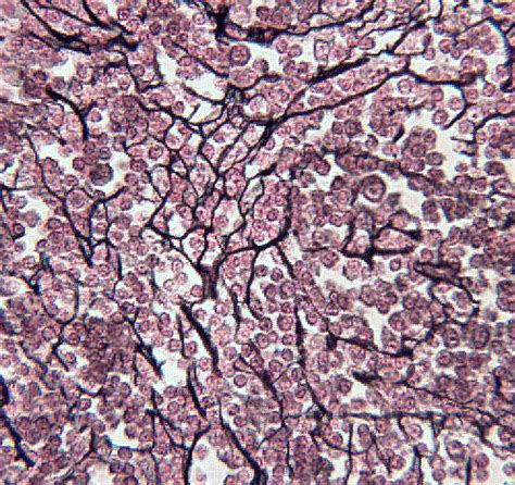 Histology of the Connective Tissues