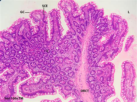 Small Intestine Histology