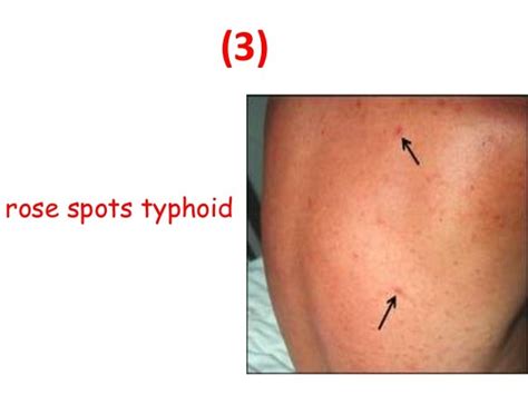 2 spot diagnosis