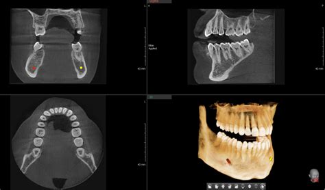 » Cone Beam CT Imaging (3D Xray)