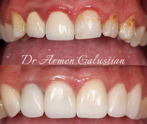 Periodontist Near Me, Calabasas CA 91302 - General And Family Dentistry ...