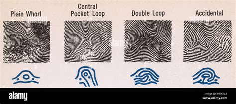 Radial Loop Fingerprint