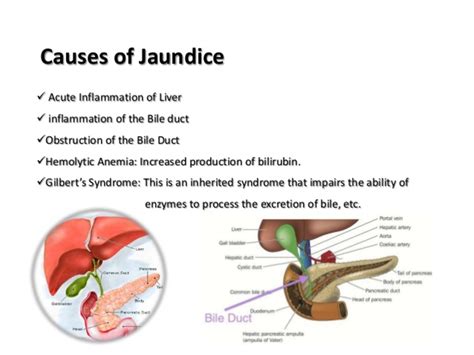 The Pathology of the LIVER | hubpages