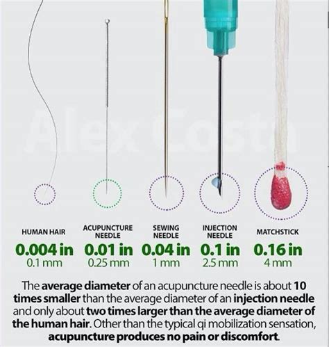 Acupuncture - How Does Acupuncture Work - Benefits & Side Effects