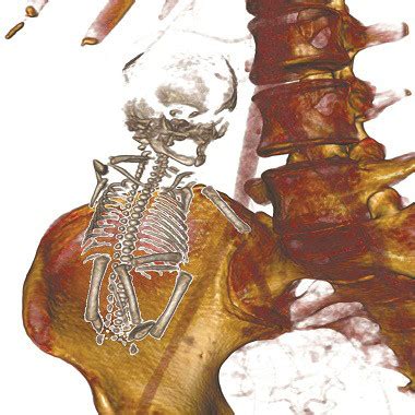 3D Anatomy & Virtual Dissection Platform | Anatomage Table