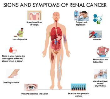 CAR-T Cell Immunotherapy & Stem Cells for Kidney Cancer RCC