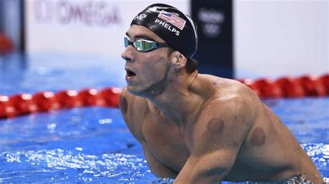 Rio 2016: Michael Phelps cupping therapy benefits - Sports Illustrated