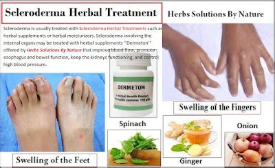 Herbal Treatment of Scleroderma Scarring of the Skin Joints