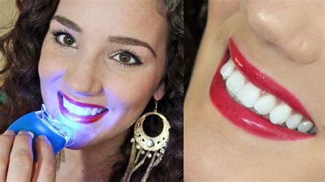 White And Bright Teeth Whitening Review - TeethWalls