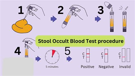 Stool occult blood test procedure step by step in lab