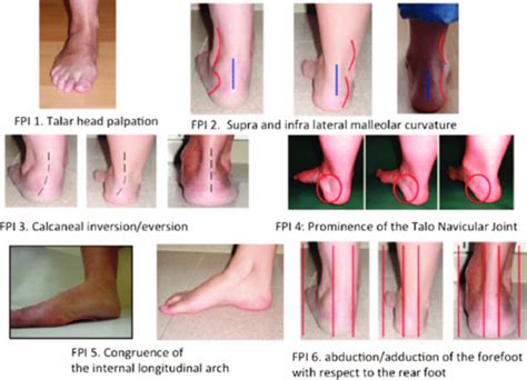 Valgus Vs Varus Of Ankle