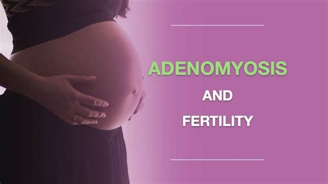 Adenomyosis and Fertility: What You Should Know About Adenomyosis And ...