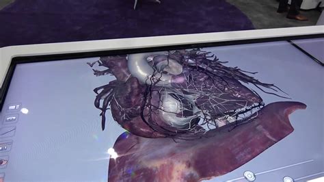 Anatomage Virtual Dissection Table Showcased at IMSH 2020 - YouTube