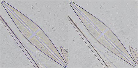 Praise for the humble Achromat | Microscopy of Nature