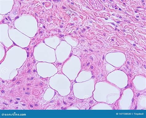 Histology Of Epiglottis Human Tissue Royalty-Free Stock Photography ...