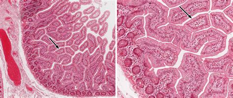 Small and Large Intestine | histology