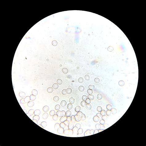 White Blood Cells Under Microscope Labeled