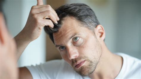 Treating Male Pattern Hair Loss | Philip Kingsley