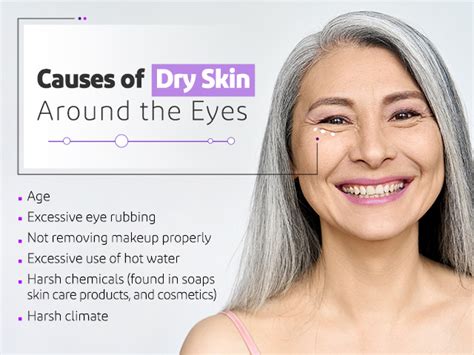 Dry Skin Around Eyes – Causes & Treatments