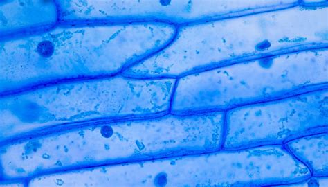 What Happens to Plant & Animal Cells When Placed in Hypertonic ...