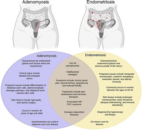 Endometriosis - Yolando Felton