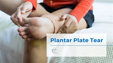 Plantar Plate Tear Injury Treatment - Moore Foot and Ankle Specialists