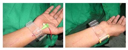 Cardiac Catheterization and Percutaneous Coronary Intervention ...