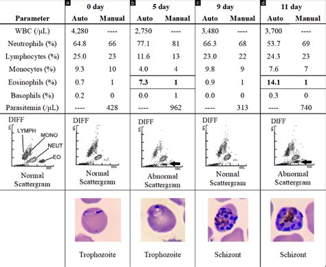 Abnormal White Blood Cell Levels