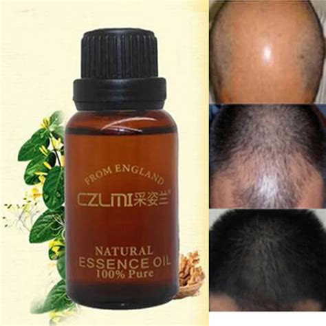 10ml/Pack Hair Boost Hair Growth Loss Products Anti Bald Alopecia Hair ...