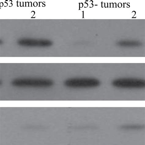 Increased α-enolase function on the Δ122p53 cell membrane. A ...