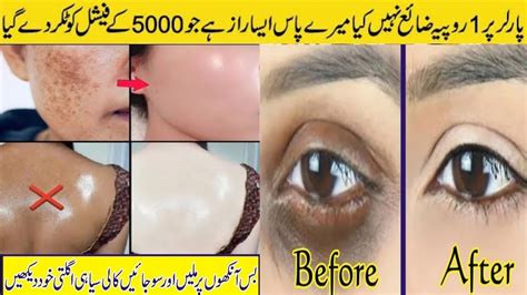 Best Skin Whitening Cream Homemade | Homeremedies for dark circles ...