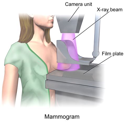 Mammography Test: Price, Purpose, Types, Procedure & Results [2024]