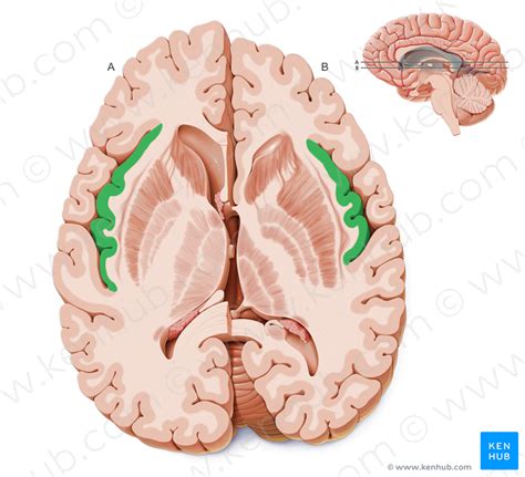 Pin on Brain.Lateral view