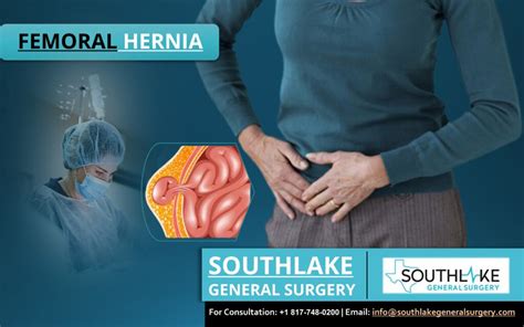 Femoral Hernia Surgery at Southlake General Surgery - Southlake General ...