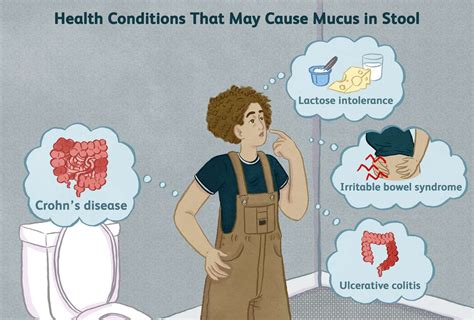 Mucus In Stool Human