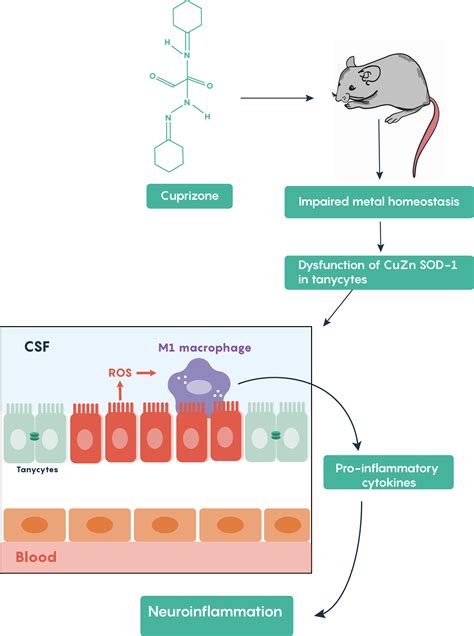 2.3 Demyelinating diseases with an emphasis on Multiple Sclerosis ...