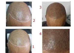 35+ Hairline Tattoo Ideas & Helpful Information You Need to Know ...