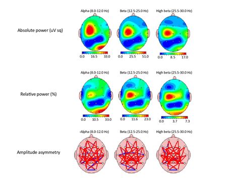 The color-coded quantitative EEG brain map upon resting, eyes-open ...