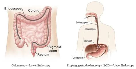 Endoscopy Services | Tomah Health