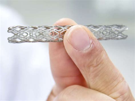 What is a stent? Uses, risks, and recovery