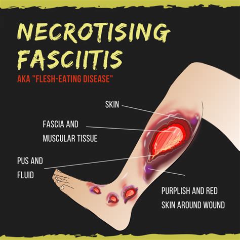 Pathogen Definition and Examples - Biology Online Dictionary