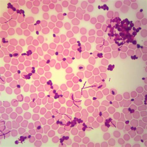 Bacteria, Yeast, and Blood, w.m. Microscope Slide | Carolina Biological ...