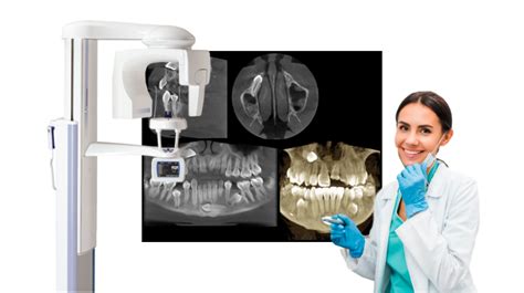 Benefits of Adding Dental Cone Beam to the General Dental Practice