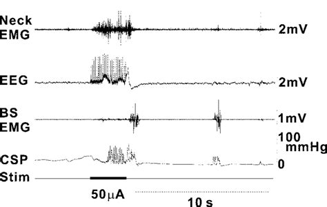 Micturition-type response that was evoked by stimulation to point "d ...