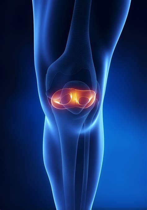 Meniscus Surgery | Knee Cartilage Repair | Orthopedic Knee Surgeon ...