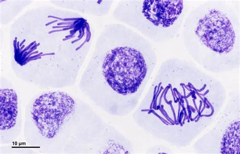 Mitosis anatomy and physiology – CollegeLearners.com