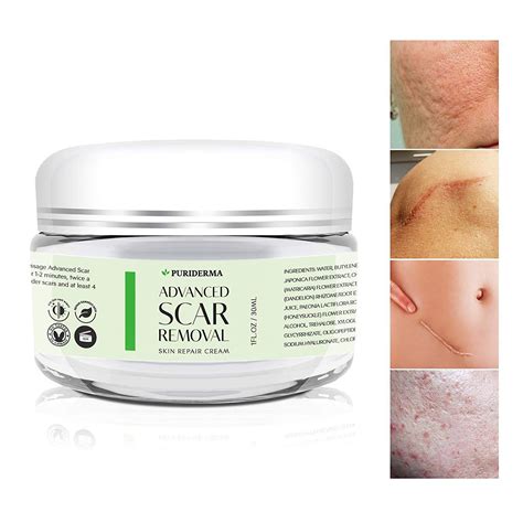 The 7 Best Scar Creams of 2020