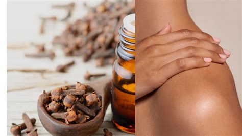 The Magical Benefits of Clove Oil for Your Skin | clove oil, natural ...