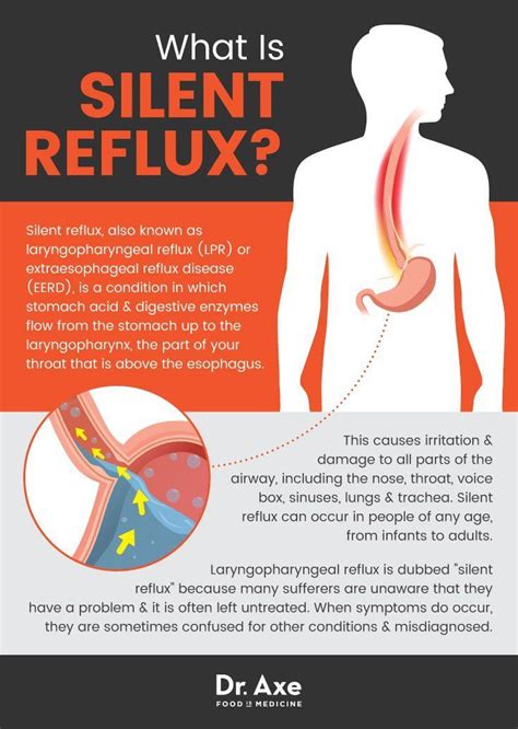 How To Relieve From Gastritis | carfare.me 2019-2020