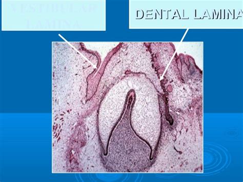 Oral Histology "tooth development"